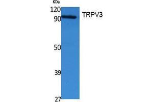 Western Blotting (WB) image for anti-Transient Receptor Potential Cation Channel, Subfamily V, Member 3 (TRPV3) (Internal Region) antibody (ABIN3187651) (TRPV3 抗体  (Internal Region))