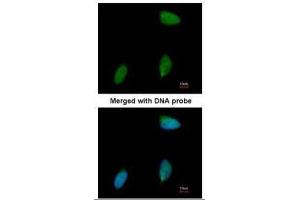 ICC/IF Image Immunofluorescence analysis of paraformaldehyde-fixed human pancreatic cancer cell line, using ERG, antibody at 1:50 dilution. (ERG 抗体  (C-Term))