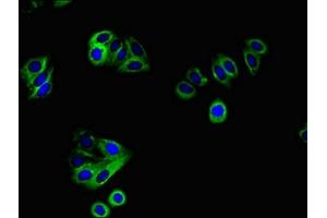 Immunofluorescent analysis of HepG2 cells using ABIN7167466 at dilution of 1:100 and Alexa Fluor 488-congugated AffiniPure Goat Anti-Rabbit IgG(H+L) (ERBB4 抗体  (AA 1027-1204))