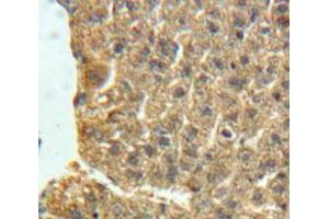 Used in DAB staining on fromalin fixed paraffin-embedded Liver tissue (NPX1 抗体  (AA 115-364))