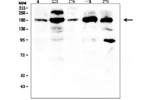 Western blot analysis of PDGFRA using anti- PDGFRA antibody . (PDGFRA 抗体  (C-Term))