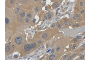 DAB staining on IHC-P; Samples: Human Esophagus (LGALS7 抗体  (AA 1-136))