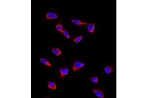 Image no. 2 for anti-CD9 (CD9) (Middle Region) antibody (ABIN5552041) (CD9 抗体  (Middle Region))