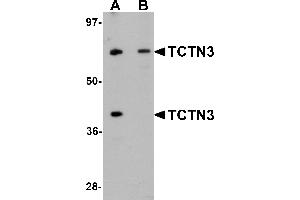 Western Blotting (WB) image for anti-Tectonic Family Member 3 (TCTN3) (C-Term) antibody (ABIN1030726) (TCTN3 抗体  (C-Term))