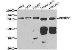 Western blot analysis of extracts of various cell lines, using CENPC antibody. (Centromere Protein C Pseudogene 1 (CENPCP1) (AA 1-300) 抗体)