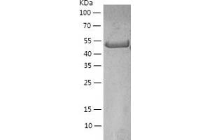 Vimentin (VIM) (AA 2-466) protein (His-IF2DI Tag)