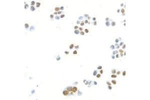 Immunocytochemistry (ICC) image for anti-Mediator Complex Subunit 1 (MED1) (AA 1550-1581) antibody (ABIN7455140)