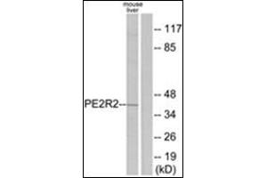 Western blot analysis of extracts from mouse liver cells, using PE2R2 Antibody. (PTGER2 抗体  (C-Term))