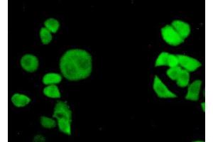 Figure:FITC staining on IHC-P Simple: Hela cells (Transportin 1 抗体  (AA 593-836))