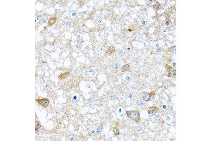 Immunohistochemistry of paraffin-embedded rat brain using BMP5 antibody at dilution of 1:100 (40x lens). (BMP5 抗体)