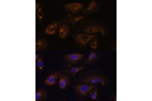 Immunofluorescence analysis of U-2 OS cells using PRSS8 antibody (ABIN7269583) at dilution of 1:100. (PRSS8 抗体  (C-Term))