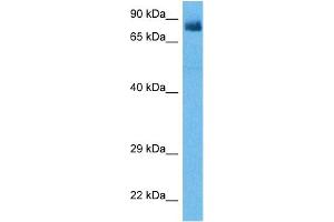 Western Blotting (WB) image for anti-Receptor-Interacting Serine-threonine Kinase 4 (RIPK4) (Middle Region) antibody (ABIN2782391)