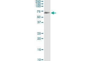 Immunoprecipitation of RDX transfected lysate using anti-RDX MaxPab rabbit polyclonal antibody and Protein A Magnetic Bead , and immunoblotted with RDX purified MaxPab mouse polyclonal antibody (B01P) . (Radixin 抗体  (AA 1-583))