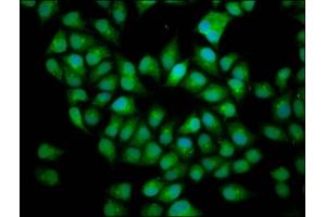 Immunofluorescence staining of Hela cells with ABIN7165140 at 1:166, counter-stained with DAPI. (BICD2 抗体  (AA 511-625))