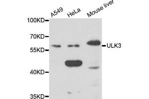 Western blot analysis of extracts of various cell lines, using ULK3 antibody. (ULK3 抗体)