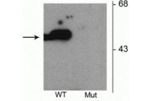 Western blot of HEK293 cells transfected with Parkin wild type (WT) and Parkin S101 mutant (Mut) showing the specific immunolabeling of the ~52 kDa parkin protein phosphorylated at Ser101. (Parkin 抗体  (pSer101))