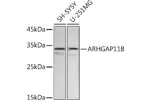 Western blot analysis of extracts of various cell lines, using B antibody (ABIN7269963) at 1:500 dilution. (ARHGAP11B 抗体  (AA 218-267))