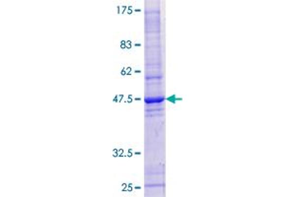 HRASLS Protein (AA 1-168) (GST tag)