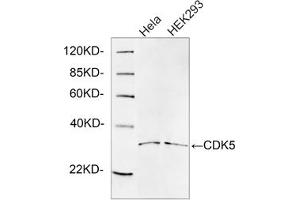 Western blot analysis of cell lysates using 1 µg/mL Rabbit Anti-CDK5 Polyclonal Antibody (ABIN398921) The signal was developed with IRDyeTM 800 Conjugated Goat Anti-Rabbit IgG.