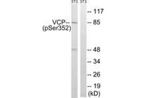 Western blot analysis of extracts from NIH-3T3 cells treated with starved 24h, using VCP (Phospho-Ser352) Antibody. (VCP 抗体  (pSer352))