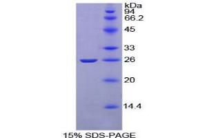 SDS-PAGE analysis of Rat Complement Receptor 2 Protein. (CD21 蛋白)