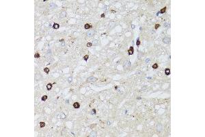Immunohistochemistry of paraffin-embedded rat brain using MIP antibody at dilution of 1:100 (x40 lens). (MIP 抗体)