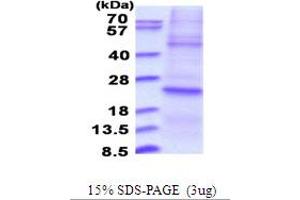 SDS-PAGE (SDS) image for Dual Specificity Phosphatase 22 (DUSP22) (AA 1-184) protein (His tag) (ABIN5853708) (DUSP22 Protein (AA 1-184) (His tag))