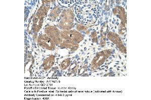 Rabbit Anti-ACP1 Antibody  Paraffin Embedded Tissue: Human Kidney Cellular Data: Epithelial cells of renal tubule Antibody Concentration: 4. (ACP1 抗体  (N-Term))