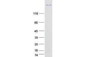 Western Blotting (WB) image for BCL6 Co-Repressor (BCOR) (Transcript Variant 3) protein (Myc-DYKDDDDK Tag) (ABIN2715205)