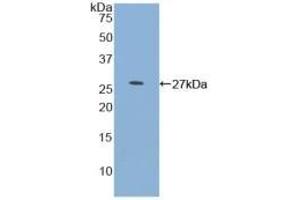 Detection of Recombinant MYOC, Human using Polyclonal Antibody to Myocilin (MYOC) (MYOC 抗体  (AA 224-471))