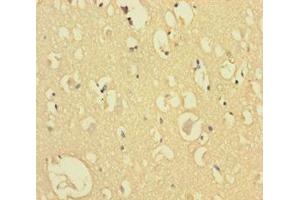 Immunohistochemistry of paraffin-embedded human brain tissue using ABIN7148784 at dilution of 1:100 (CXXC5 抗体  (AA 1-227))