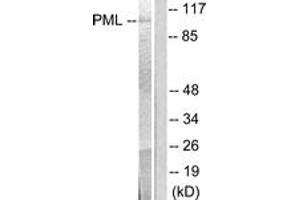 Western blot analysis of extracts from A549 cells, using PML Antibody. (PML 抗体  (AA 11-60))