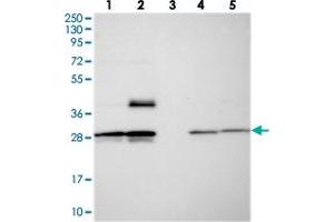 Western blot analysis of Lane 1: RT-4, Lane 2: U-251 MG, Lane 3: Human Plasma, Lane 4: Liver, Lane 5: Tonsil with MXRA7 polyclonal antibody  at 1:250-1:500 dilution. (MXRA7 抗体)