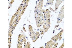 Immunohistochemistry of paraffin-embedded Human esophageal smooth muscle using MRPL12 Polyclonal Antibody at dilution of 1:100 (40x lens). (MRPL12 抗体)