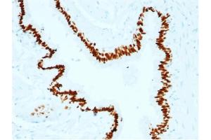 Immunohistochemistry (IHC) image for anti-SRY (Sex Determining Region Y)-Box 2 (SOX2) (AA 176-305) antibody (ABIN6940611)