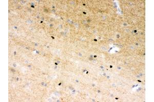 Anti- PARP Picoband antibody, IHC(P) IHC(P): Rat Brain Tissue (PARP1 抗体  (AA 670-858))