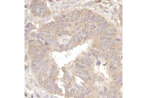 Immunohistochemistry (IHC) image for anti-Eukaryotic Translation Initiation Factor 2A, 65kDa (EIF2A) (AA 450-500) antibody (ABIN7454423)
