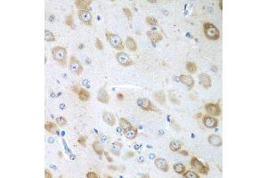 Immunohistochemistry of paraffin-embedded mouse brain using GFM1 antibody at dilution of 1:100 (40x lens). (GFM1 抗体)