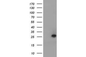 Image no. 1 for anti-Ubiquitin-Conjugating Enzyme E2E 3 (UBE2E3) antibody (ABIN1501619) (UBE2E3 抗体)