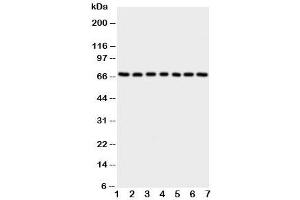 Western blot testing of NOX4 antibody and Lane 1:  rat kidney (NADPH Oxidase 4 抗体  (C-Term))