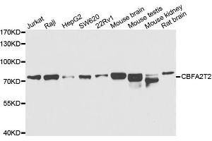 Western blot analysis of extracts of various cell lines, using CBFA2T2 antibody. (CBFA2T2 抗体  (AA 325-604))