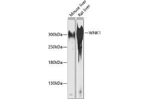 Western blot analysis of extracts of various cell lines, using WNK1 antibody  at 1:1000 dilution. (WNK1 抗体  (AA 1-210))