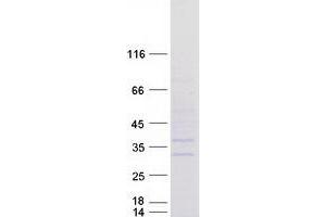 Abhydrolase Domain Containing 14A (ABHD14A) protein (Myc-DYKDDDDK Tag)