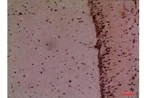 Immunohistochemistry (IHC) image for anti-Cullin 4B (CUL4B) (Internal Region) antibody (ABIN3187726)