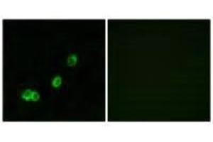 Immunofluorescence analysis of MCF-7 cells, using ACOT1 antibody. (ACOT1 抗体)