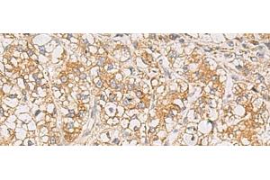 Immunohistochemistry (Paraffin-embedded Sections) (IHC (p)) image for anti-Protein Tyrosine Phosphatase, Receptor Type, N (PTPRN) antibody (ABIN7251919)
