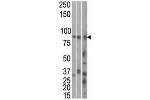 The MARK1 antibody used in western blot to detect MARK1 in HeLa, T47D, and mouse brain cell line/ tissue lysate (left to right) (MARK1 抗体  (AA 671-700))
