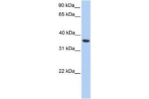 Western Blotting (WB) image for anti-Melanoma Antigen Family A, 4 (MAGEA4) antibody (ABIN2459747) (MAGEA4 抗体)