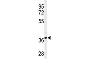 Western blot analysis of SIRT3 antibody and CHO lysate (SIRT3 抗体  (AA 304-334))