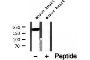 Western blot analysis of extracts of mouse heart tissue, using MYH7-specific antibody. (MYH7 抗体  (C-Term))